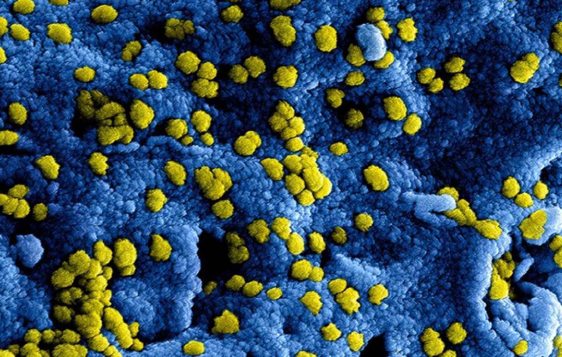 Yellow Fungus Infection: Definition, Symptoms, Prevention