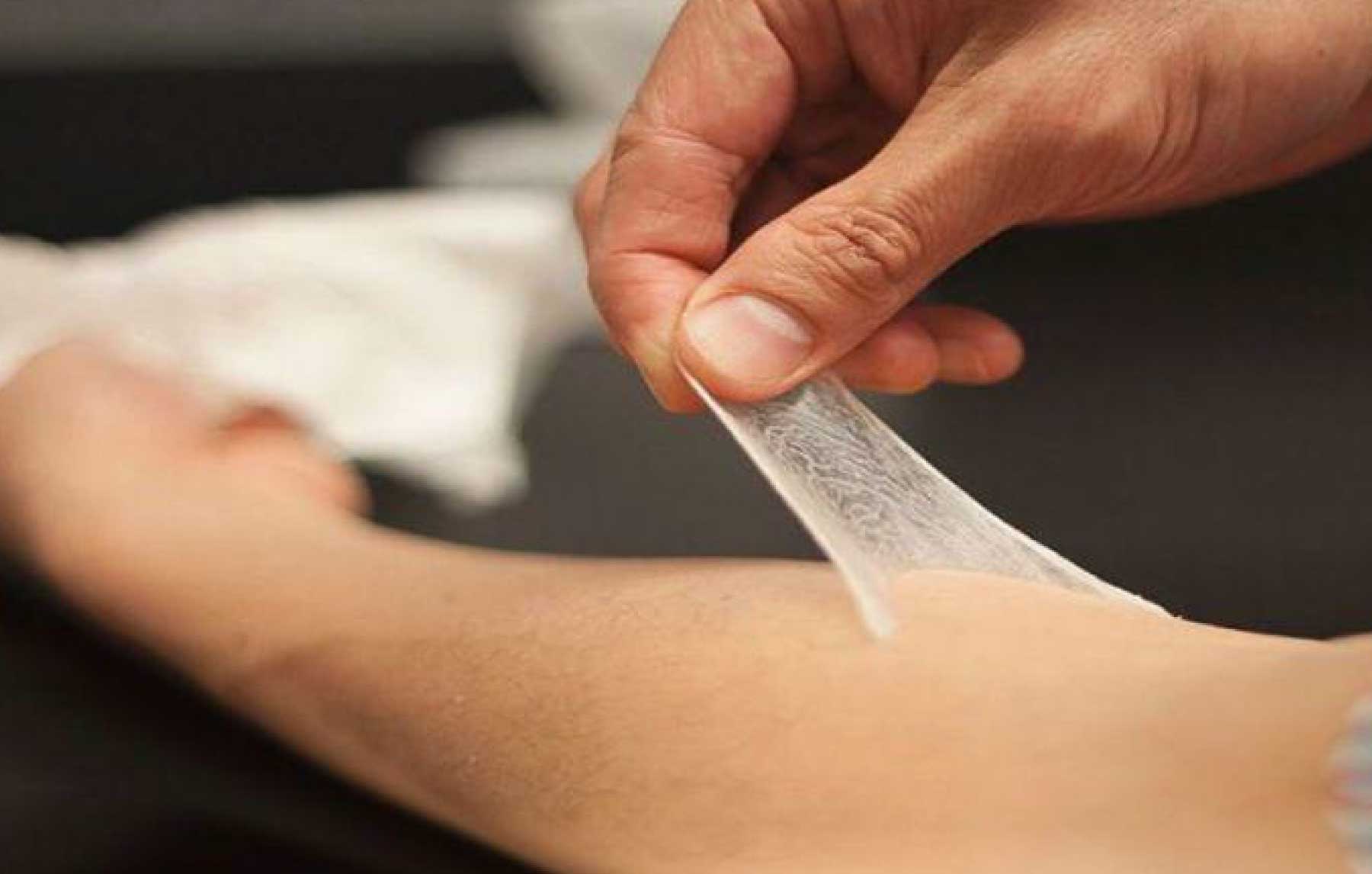 Skin Grafting: Important Things You Need To Know?