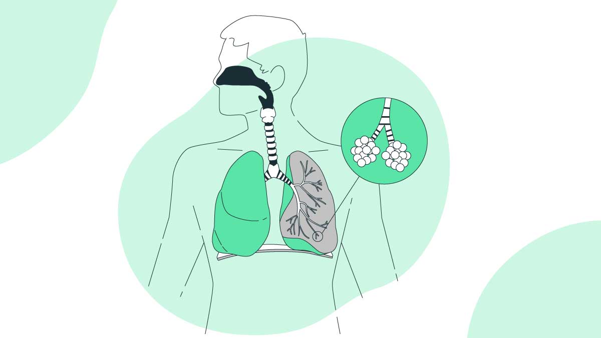 Tuberculosis, how to diagnose pulmonary tuberculosis, what tuberculosis tb, what is tuberculosis lymph nodes, what kills tuberculosis