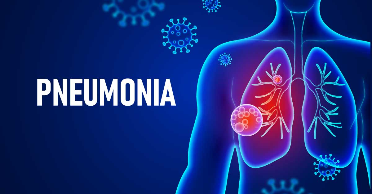 pneumonia vaccine, pneumonia symptoms, walking pneumonia, covid pneumonia