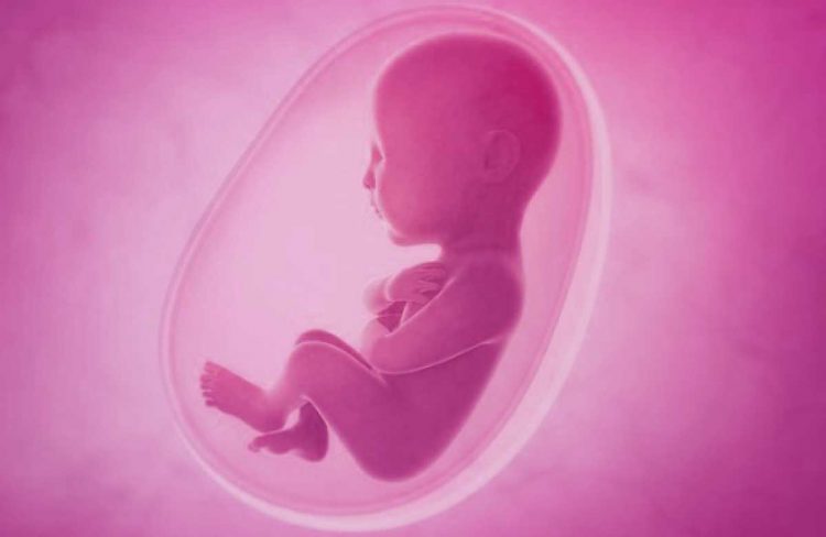 Oligohydraminos : Low amniotic fluid symptoms and signs